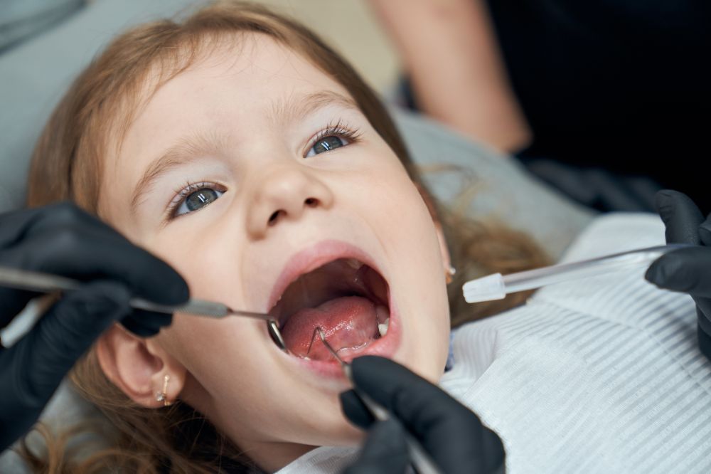 7 easy home checks to spot early cavities in kids