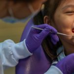 fluoride-treatment
